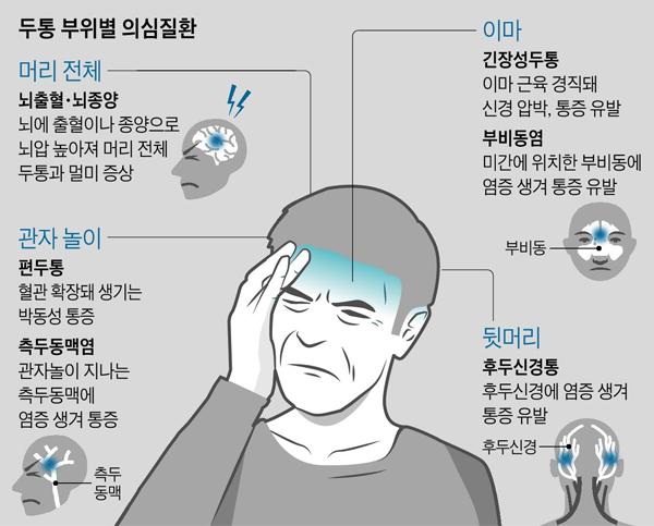 두통은 무슨 느낌임