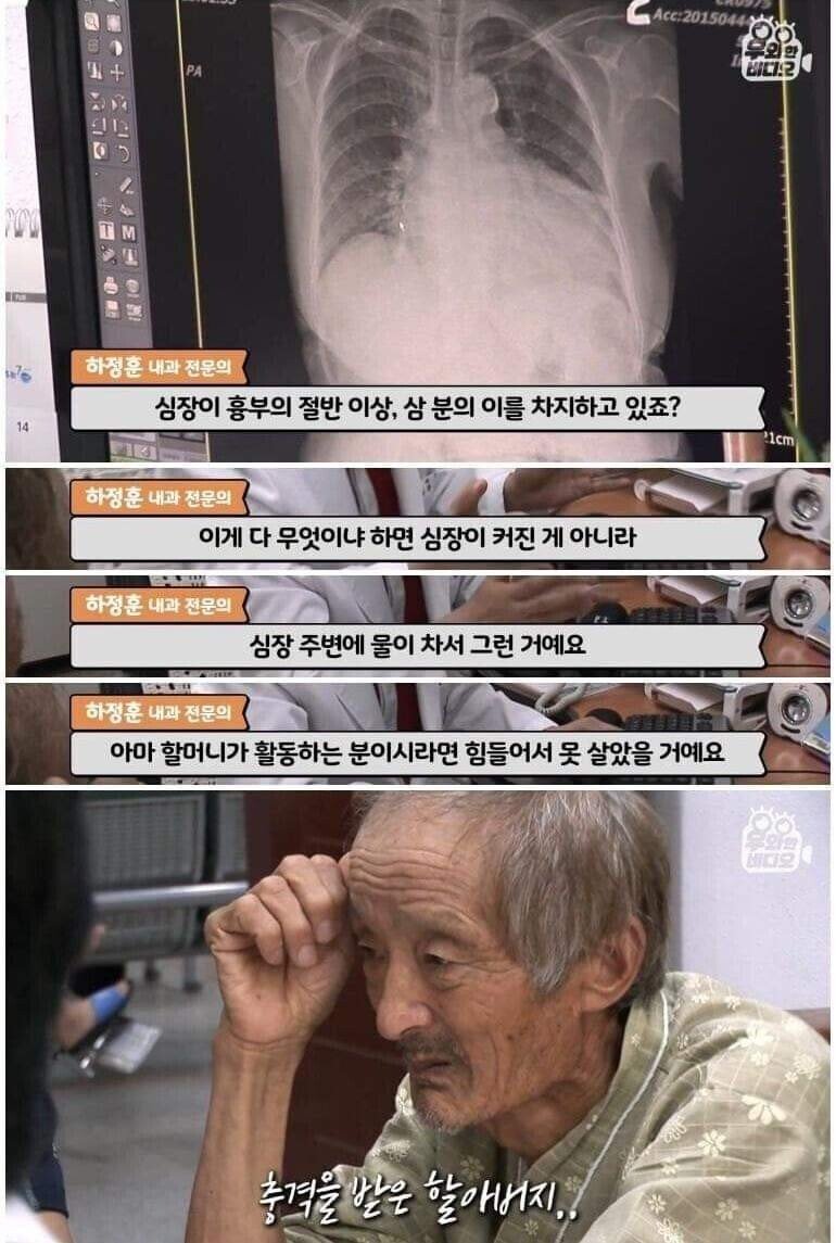 '세상에 이런 일이'에 나왔던 쓰레기집 근황.jpg