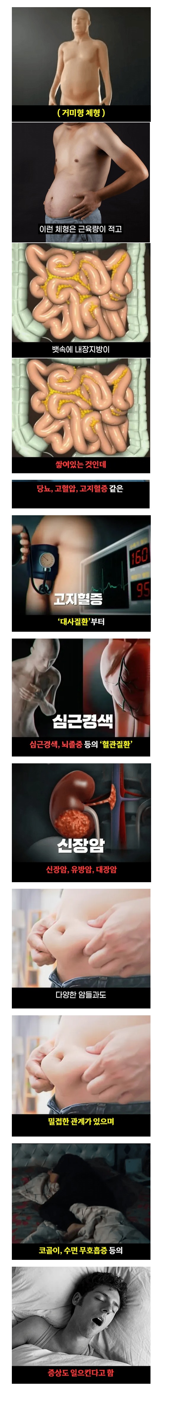 의사들이 말하는 가장 위험한 체형