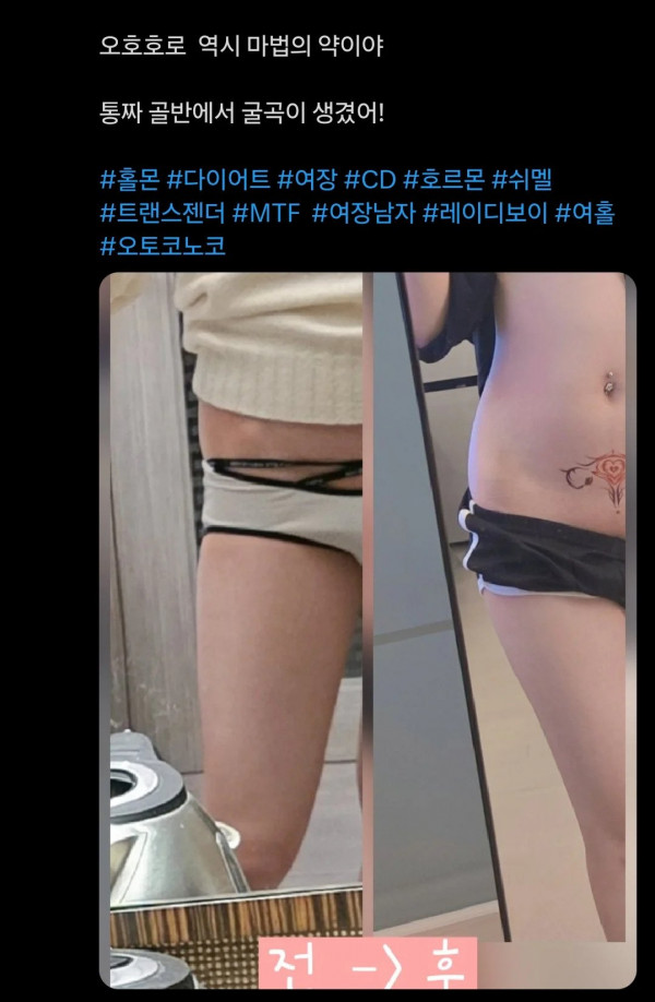 여성호르몬 10개월 맞은 결과