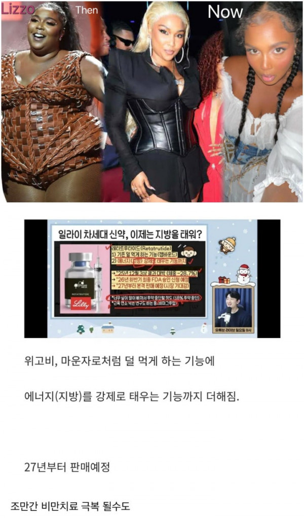 차세대 비만 치료제