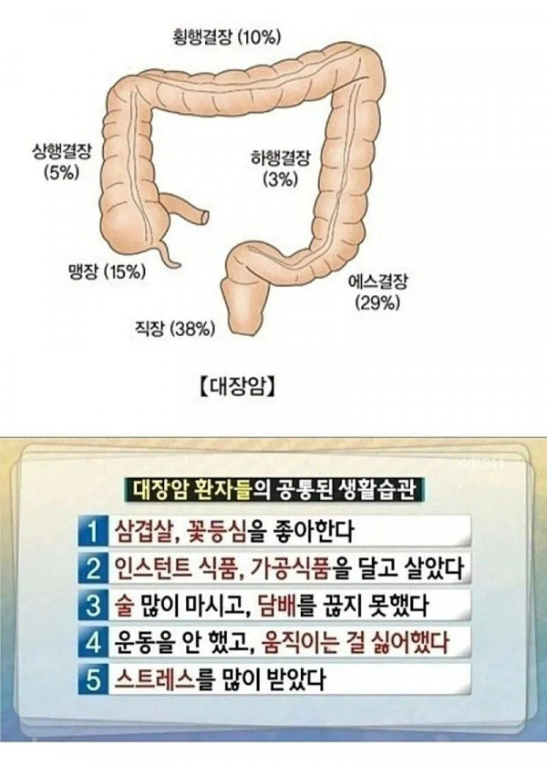 대장암 공통된 생활습관